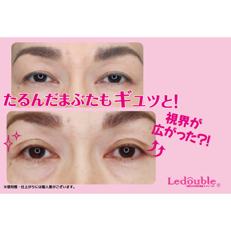 大人のルドゥーブル 2ml